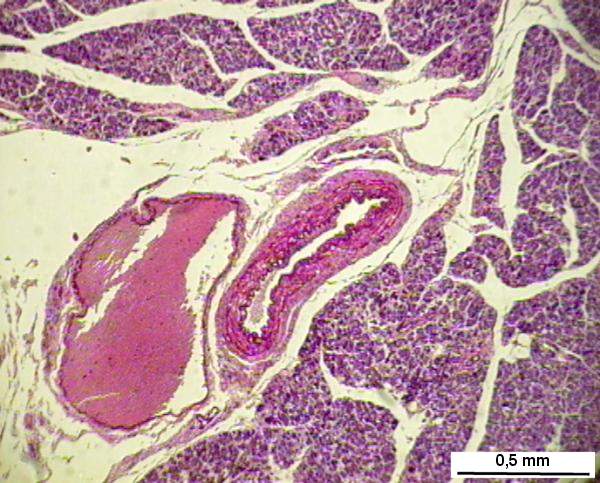 pancr06n.jpg (74809 octets)