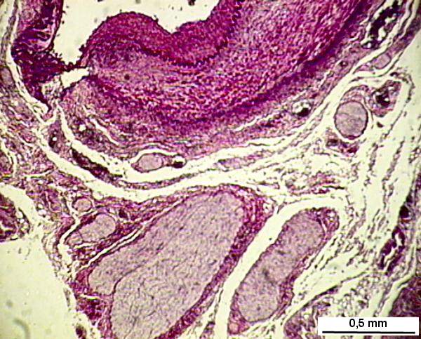 pancr10n.jpg (84829 octets)