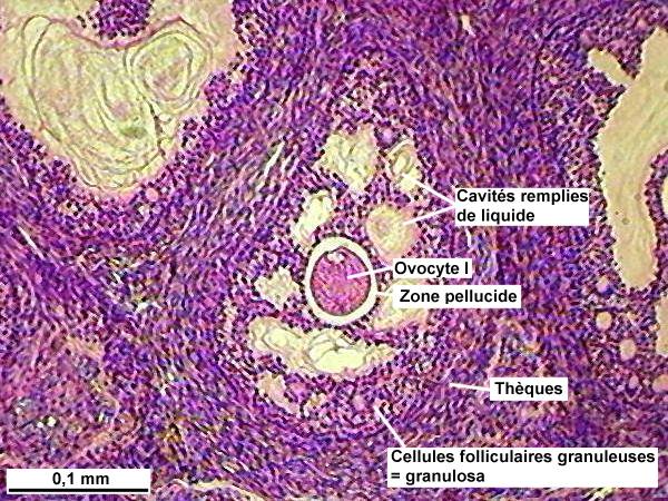 l-ov11.jpg (95947 octets)